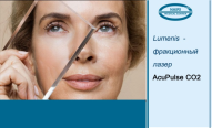 Laser skin resurfacing