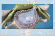 Cervical spine surgery